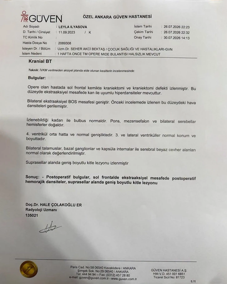 Media.az - Новости Азербайджана - 3-летней Лейле Ильясовой нужна помощь в борьбе с тяжелым заболеванием
