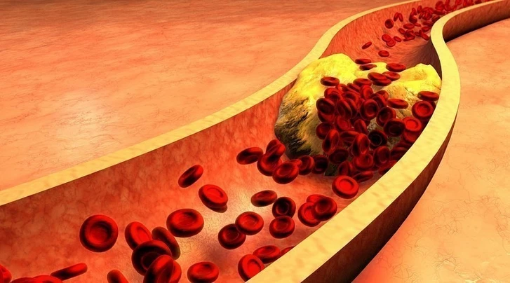 Ученые опровергли миф о вреде холестерина