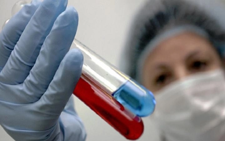 Еще 226 человек стали жертвами «свиного гриппа»