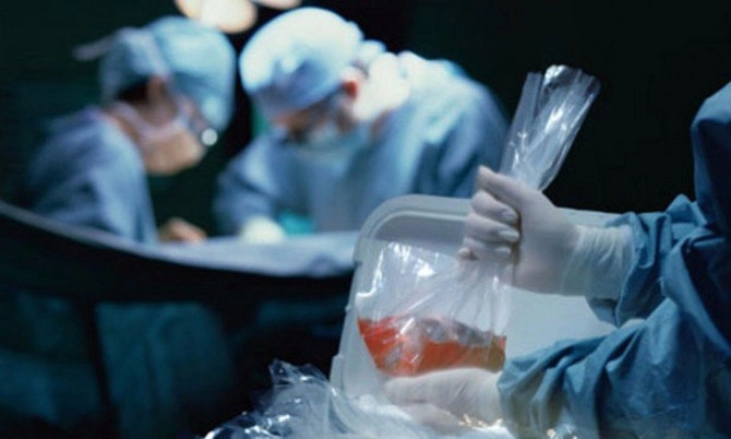 Пересадка человеку органов свиньи станет возможна в скором будущем - ФОТО