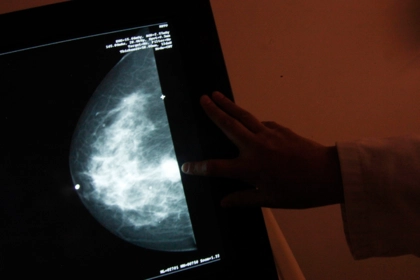 Названы главные причины рака груди