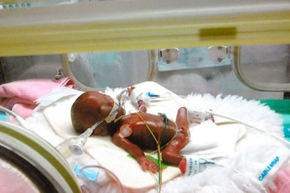 Самого маленького в мире новорожденного мальчика выходили в Японии