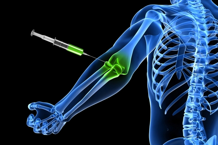 Ученые изобрели укол, восстанавливающий кости после перелома