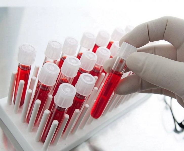 Метастазы рака предскажут по анализу крови