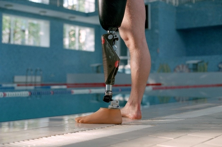 Люди с инвалидностью смогут получить протезы в центрах DOST