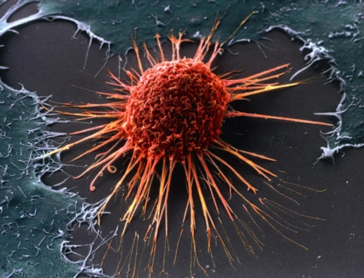 Нобелевский лауреат назвал два главных механизма развития рака