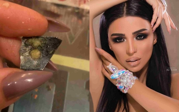 Азербайджанская танцовщица показала найденный в конфете острый кусок железа – ВИДЕО