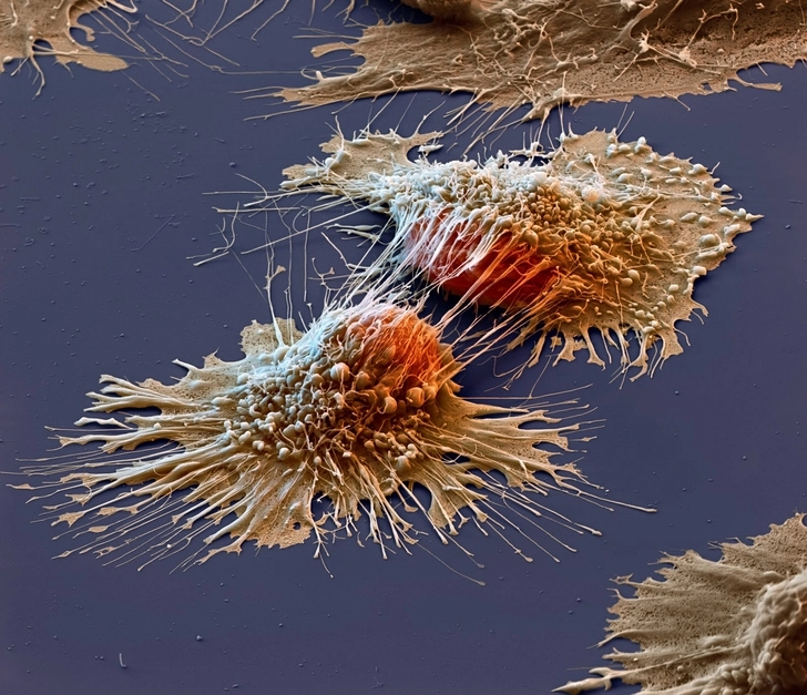 Ученые разобрались, что происходит в клеточных ядрах при развитии рака