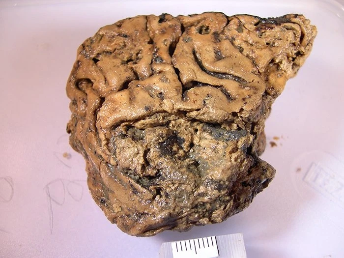 Ученые приблизились к разгадке сохранившегося 2600-летнего мозга