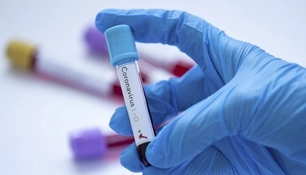 Число заболевших коронавирусом в мире растет: МИД Азербайджана предупреждает своих граждан