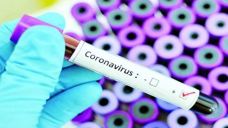 Россия передала Азербайджану 70 наборов тест-систем для лабораторной диагностики COVID-19