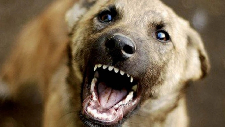 В Хачмазе малолетние дети подверглись нападению бездомной собаки – ФОТО