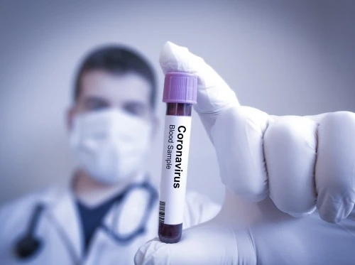 В Азербайджане сотрудники еще одной больницы заразились коронавирусом