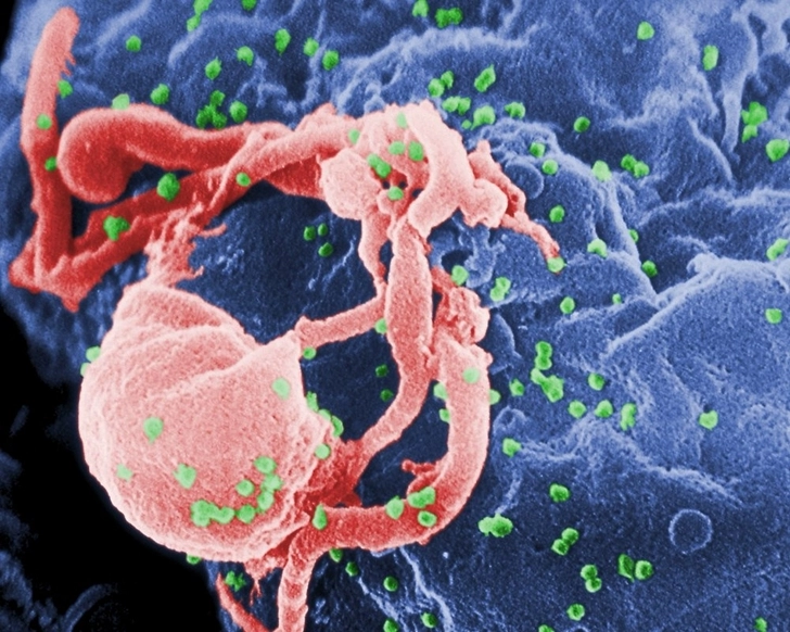 Ученые представили соединение, которое может стать вакциной от ВИЧ