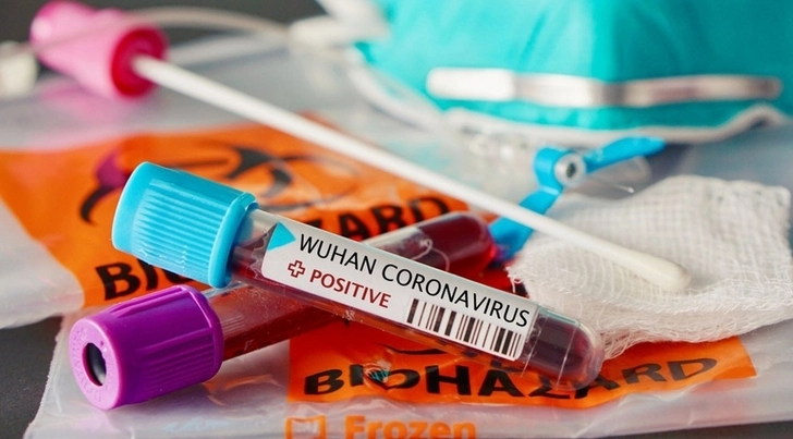 В Азербайджане от коронавируса умер еще один врач – ФОТО
