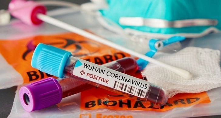 25 азербайджанских врачей скончались от коронавируса – СПИСОК