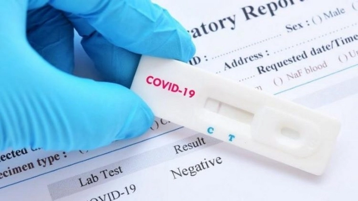 Госагентство: Ошибочные SMS-сообщения о результатах тестов на коронавирус не повлияли на общую статистику