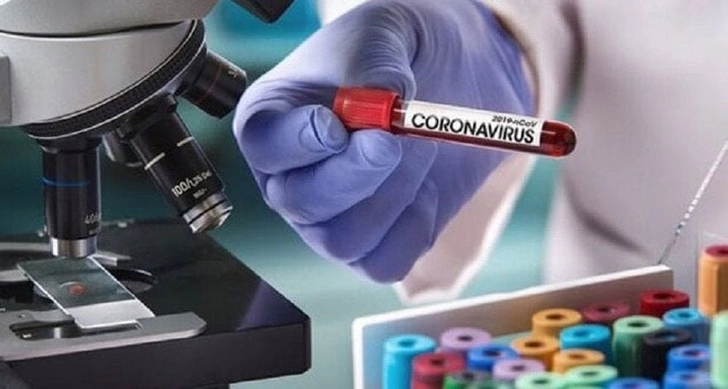 За минувшие сутки в Азербайджане провели более 7 тысяч тестов на COVID-19