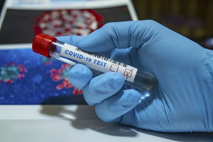 Вирусолог рассказал, как отличить коронавирус от гриппа