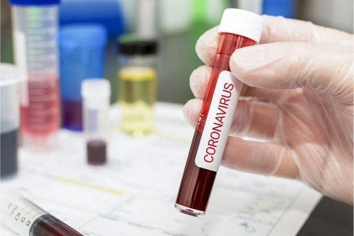 Новый антирекорд: в Азербайджане выявлено еще 3 712 случаев заражения коронавирусом