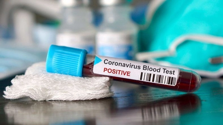 В мире за сутки выявили более 583 тыс случаев заражения коронавирусом