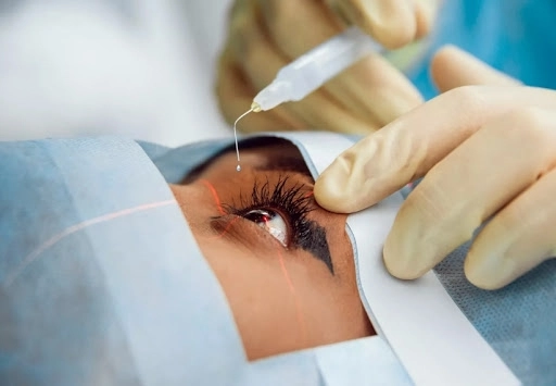 Китайские ученые нашли новый способ лечения глаз