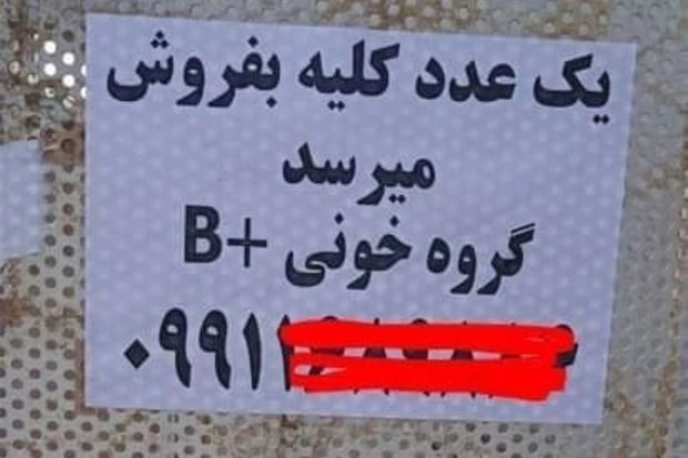 В Иране отчаявшиеся люди продают свои почки - ФОТО