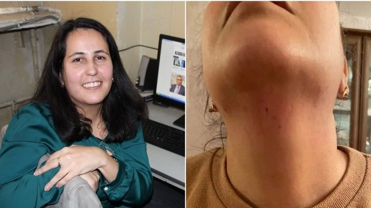 На журналистку Айтен Мамедову совершено нападение с ножом,  возбуждено уголовное дело