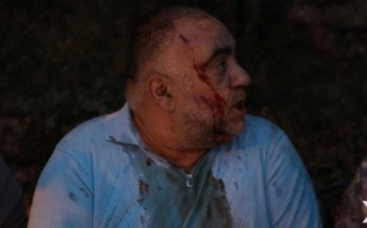 Во время протестов в Армении пострадали десятки человек - ФОТО/ВИДЕО