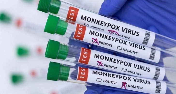 В ВОЗ отказались признавать вспышку оспы обезьян пандемией