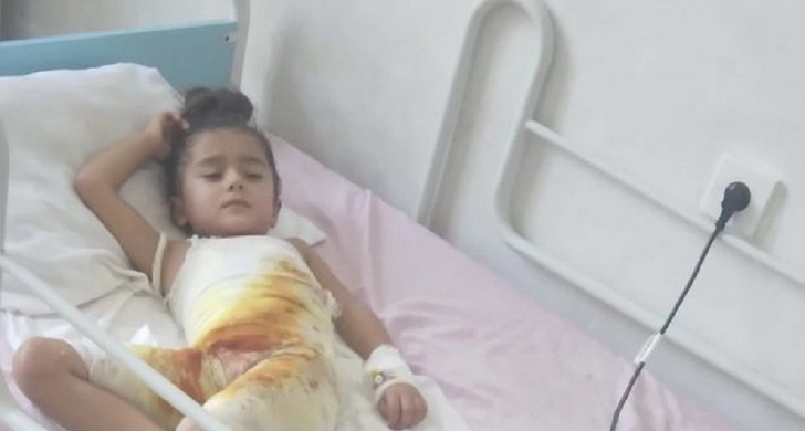 Пятилетняя Ханым обварилась кипятком: семье нужны деньги на операцию - ФОТО