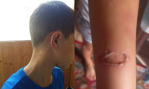 В Азербайджане женщина регулярно жестоко избивала собственного ребенка – ФОТО