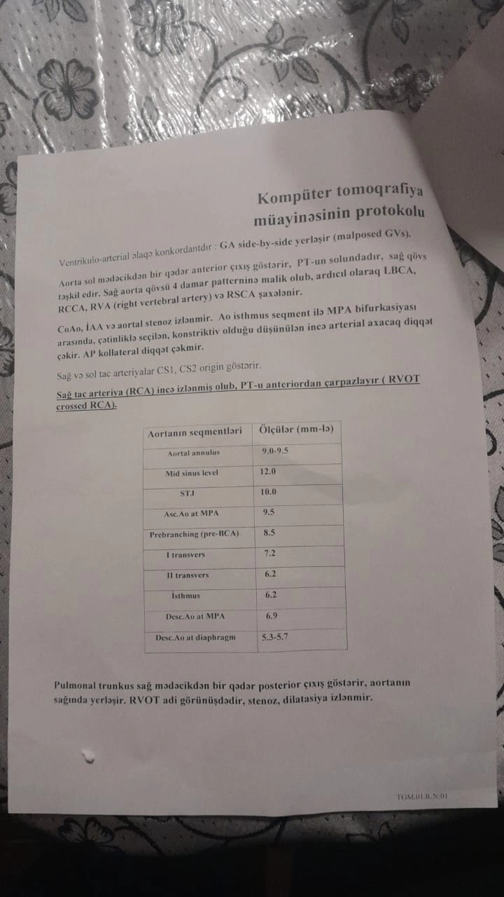 Media.az - Новости Азербайджана - Врачи говорили, что сын не проживет и трех дней. КРИК О ПОМОЩИ матери ребенка с пороком сердца