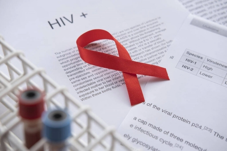 Треть ВИЧ-инфицированных в Азербайджане - женщины
