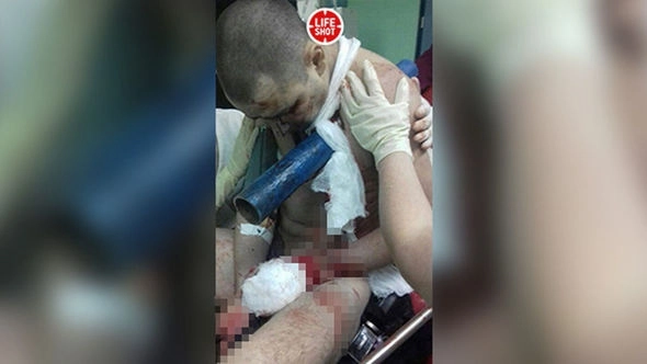 Труба пробила плечо мужчине во время аварии – ФОТО