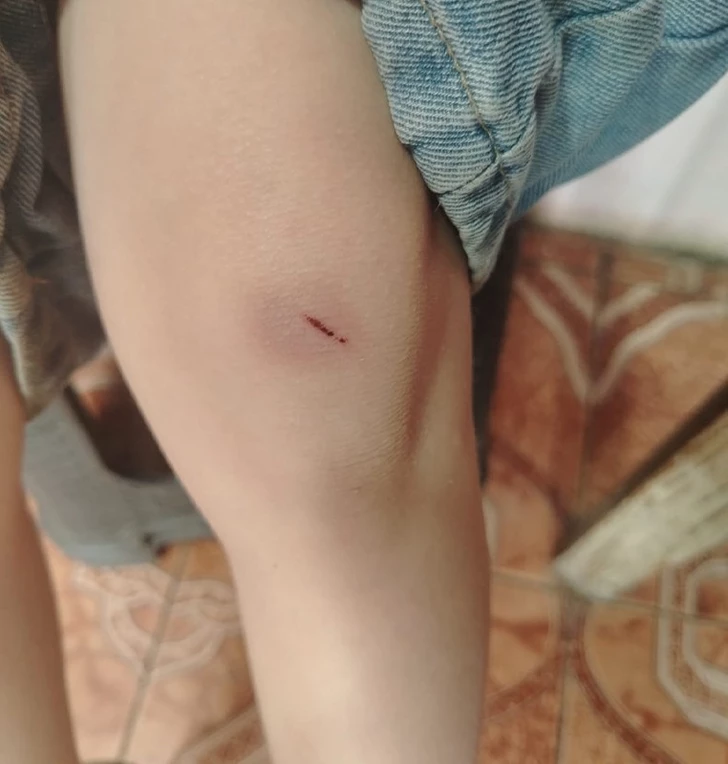 Media.az - Новости Азербайджана - В школе Гянджи четвероклассница избила ученика второго класса