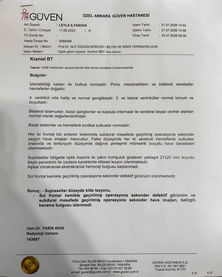 Media.az - Новости Азербайджана - 3-летней Лейле Ильясовой нужна помощь в борьбе с тяжелым заболеванием