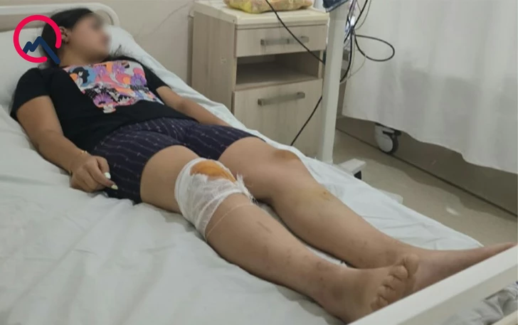 Media.az - Новости Азербайджана - В Агдашском районе вагончик аттракциона сошел с рельсов, пострадали двое подростков
