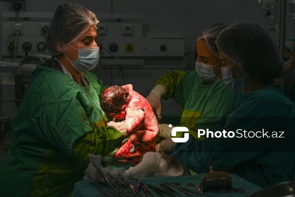 Гибель новорожденного при кесаревом сечении в Евлахе: в больнице раскрыли подробности операции