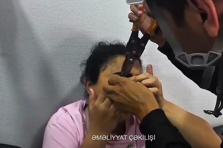 Необычный вызов в Баку: веко девушки застряло в застежке-молнии