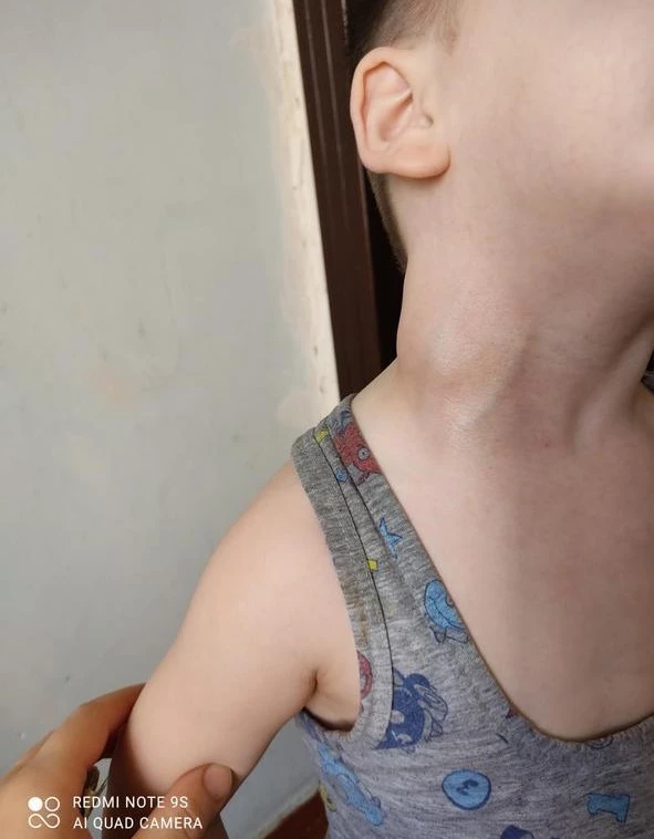Media.az - Новости Азербайджана - Тяжелая борьба за жизнь: 8-летнему Аббасу срочно требуется ПЭТ-обследование