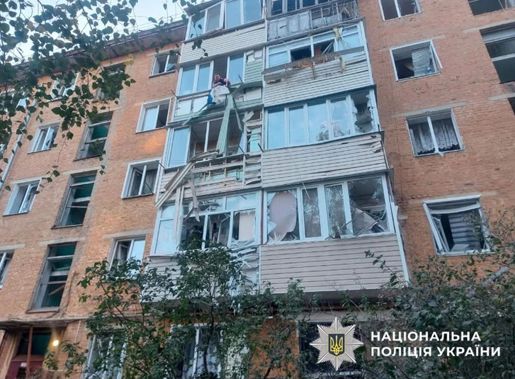 Media.az - Новости Азербайджана - Ракетные удары России по Украине: погибшие в Киеве, повреждения в Кременчуге, Запорожье и Днепре
