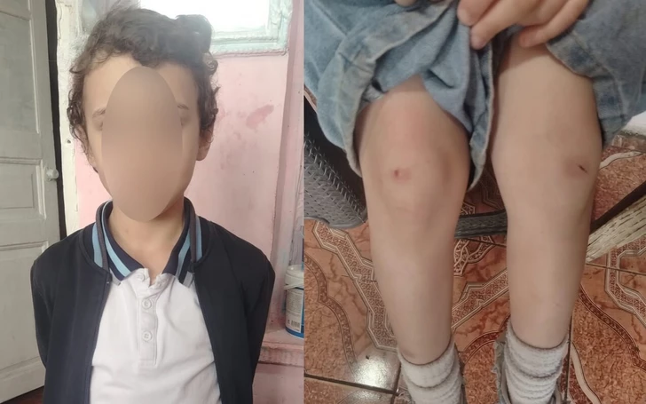 В школе Гянджи четвероклассница избила ученика второго класса