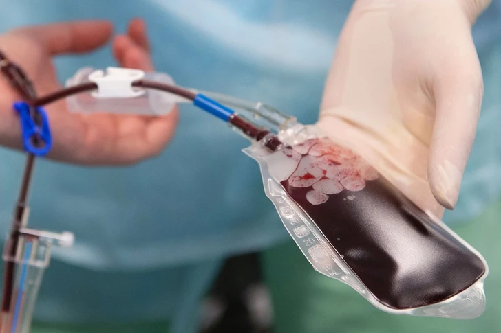 При переливании крови может передаться ряд вирусных инфекций - врач-гематолог