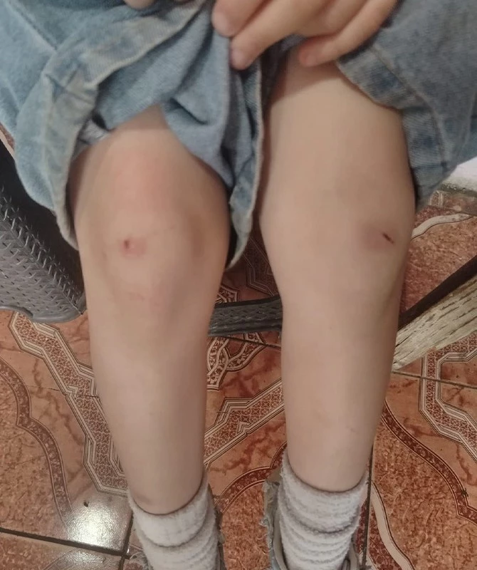 Media.az - Новости Азербайджана - В школе Гянджи четвероклассница избила ученика второго класса