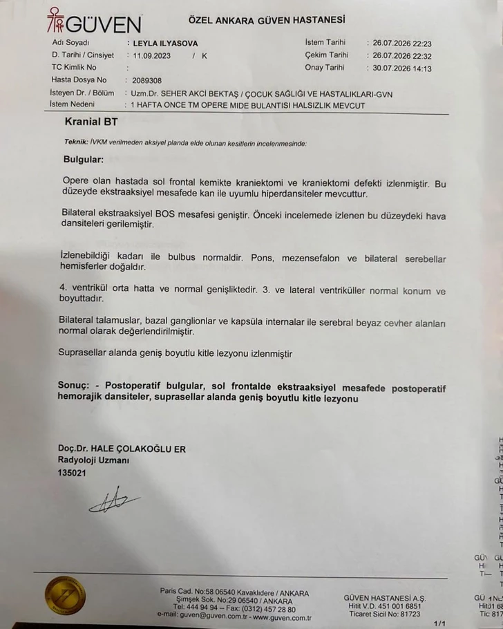 Media.az - Новости Азербайджана - 3-летней Лейле Ильясовой нужна помощь в борьбе с тяжелым заболеванием