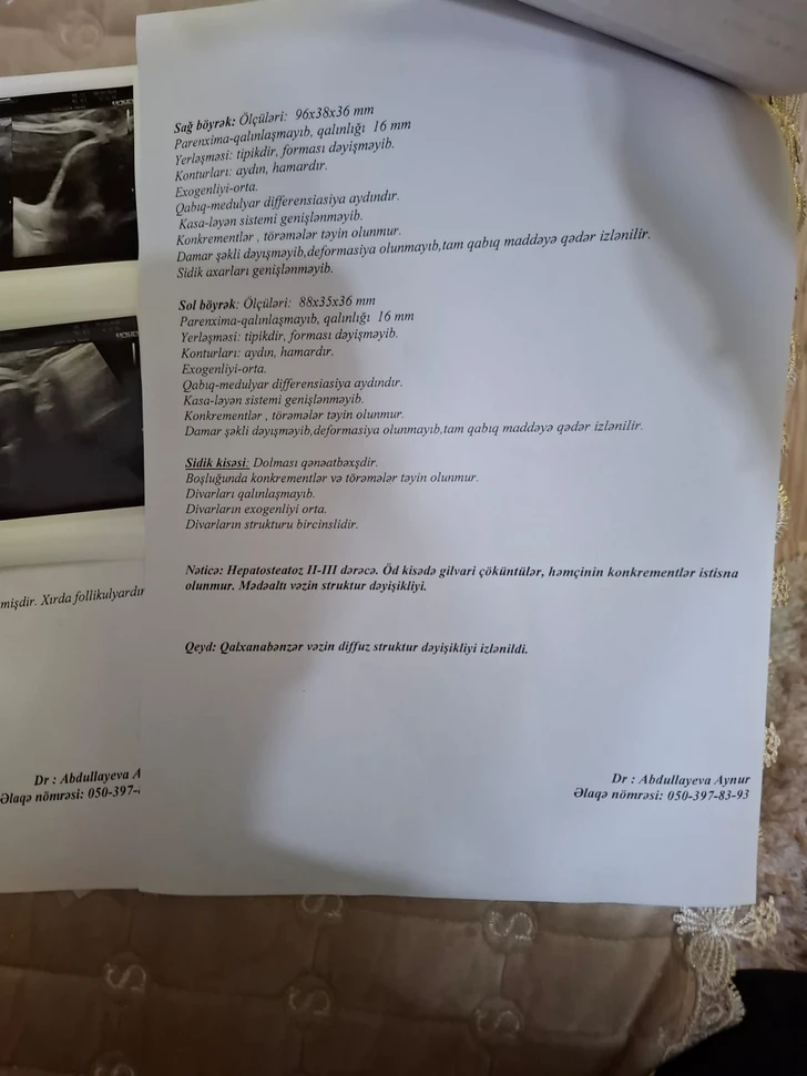 Media.az - Новости Азербайджана - Не могу продолжить лечение дочери. ПРИЗЫВ О ПОМОЩИ матери-одиночки