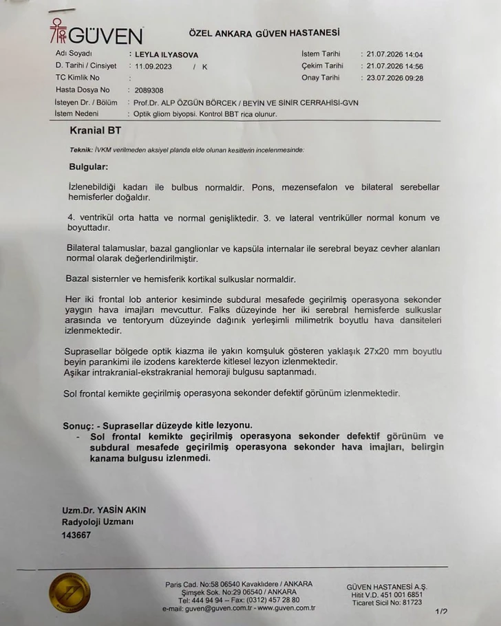 Media.az - Новости Азербайджана - 3-летней Лейле Ильясовой нужна помощь в борьбе с тяжелым заболеванием