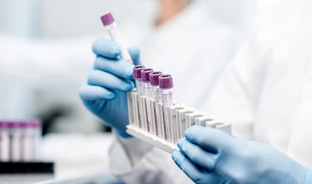 В Швейцарии зарегистрирован случай заражения хантавирусом