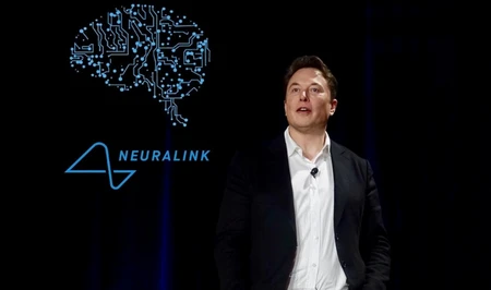 Второй человек в мире получил мозговой имплант Neuralink